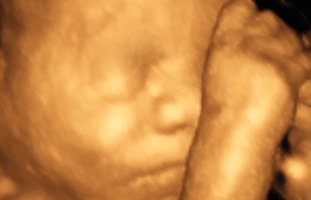 4D Ultrasound Packages